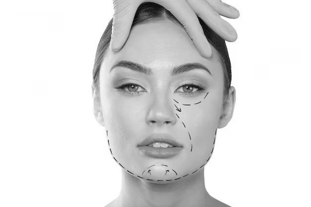 cheek & chin implants dubai