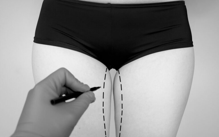 Thigh Lift in Dubai