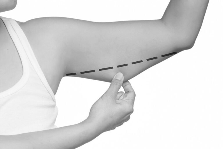 arm lift dubai