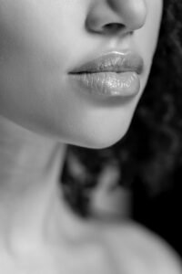 عملية رفع الشفة في دبي