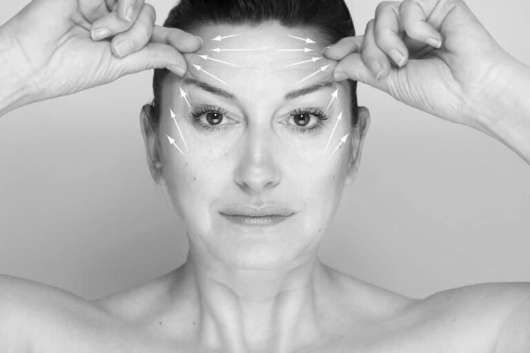 Endoscopic Forehead Lift in Dubai