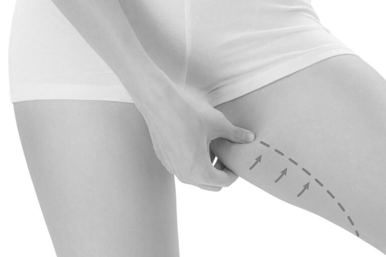 Best Thigh lift in dubai